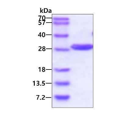 SDS-Page: Recombinant Human PRTFDC1 His Protein [NBP1-72340] - 3ug by SDS-PAGE under reducing condition and visualized by coomassie blue stain.